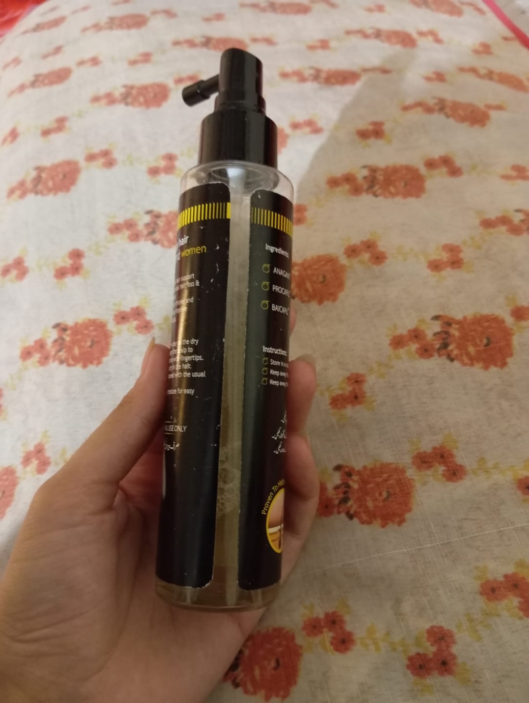 Customer photo review of Trichogain Spray For Hair Growth