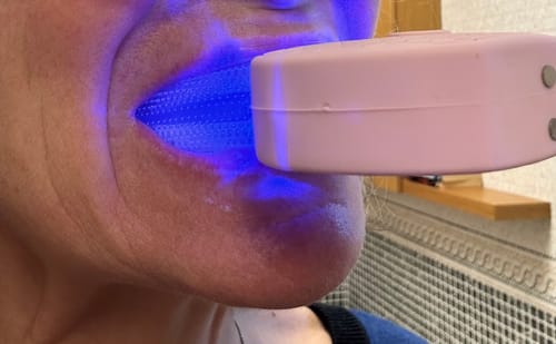 Customer photo review of Sonic Brush® V5