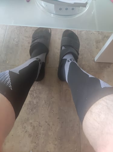 Customer photo review of ComfortFit - Kompressionsstrümpfe