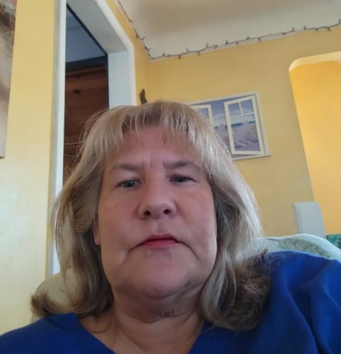 Customer photo review of Lip Stain - Peel & Reveal