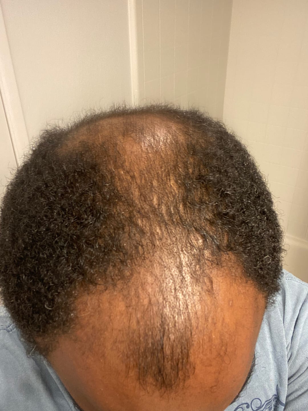 Customer photo review of Hair Oil & Hair Moisturizer Kit