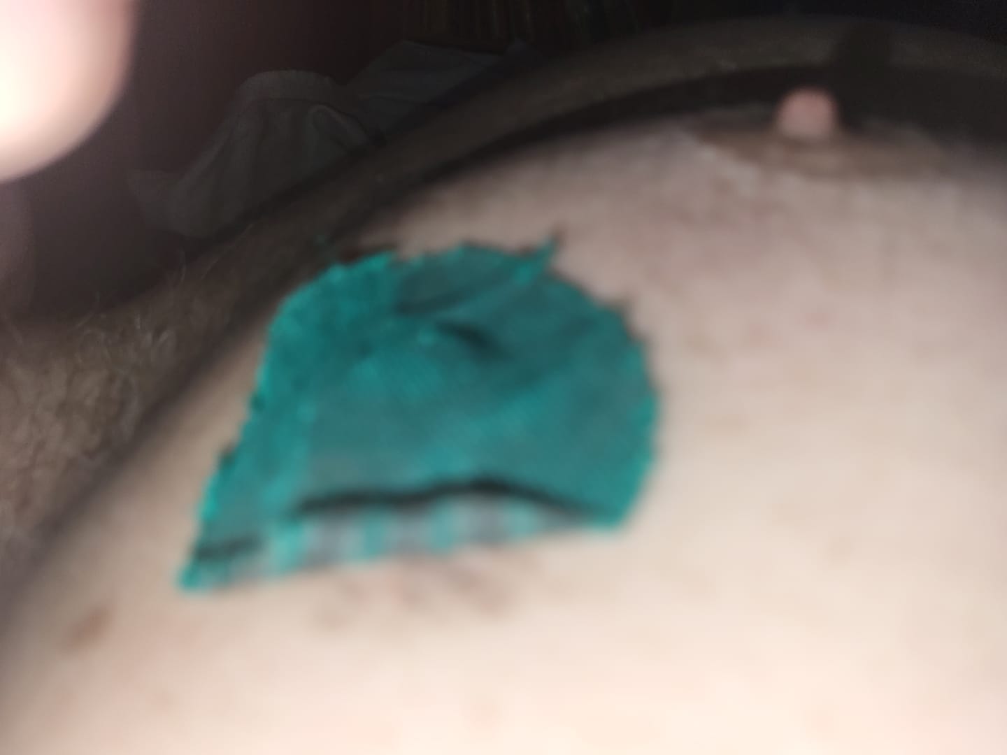 Customer photo review of Skin Grip Original - Libre 3 Adhesive Patches - 20 Pack