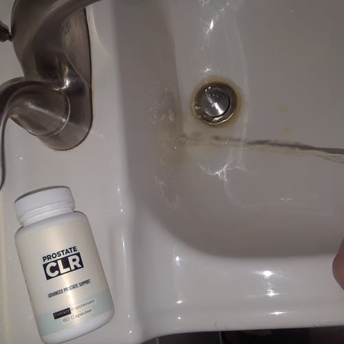 Customer photo review of BUY 2 GET 1 FREE BOTTLES OF PROSTATECLR - PROSTATE SUPPORT
