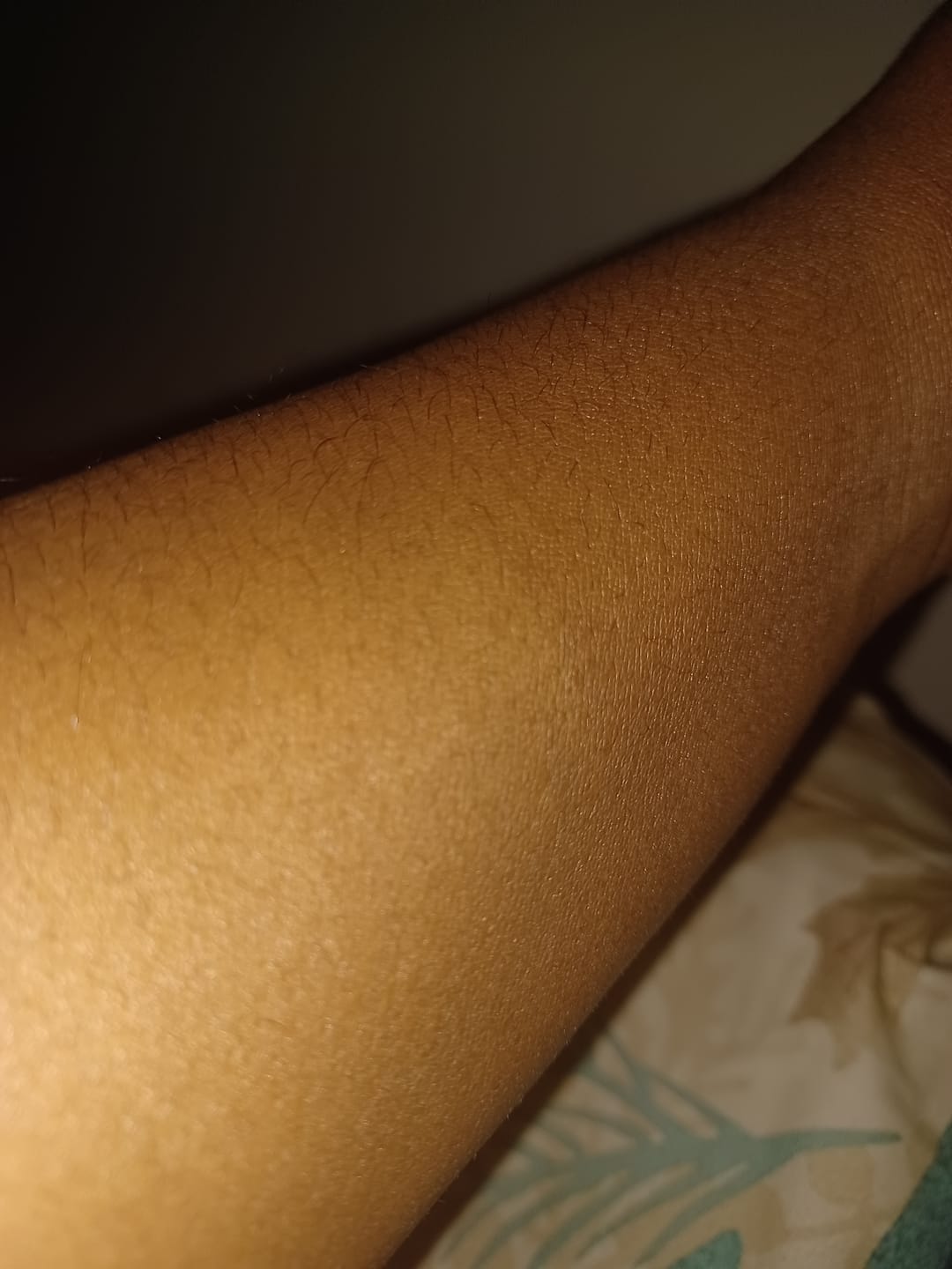 Customer photo review of Fair and White Original Glutathion Extra Brightening Lotion 500ml / 16.90 fl oz