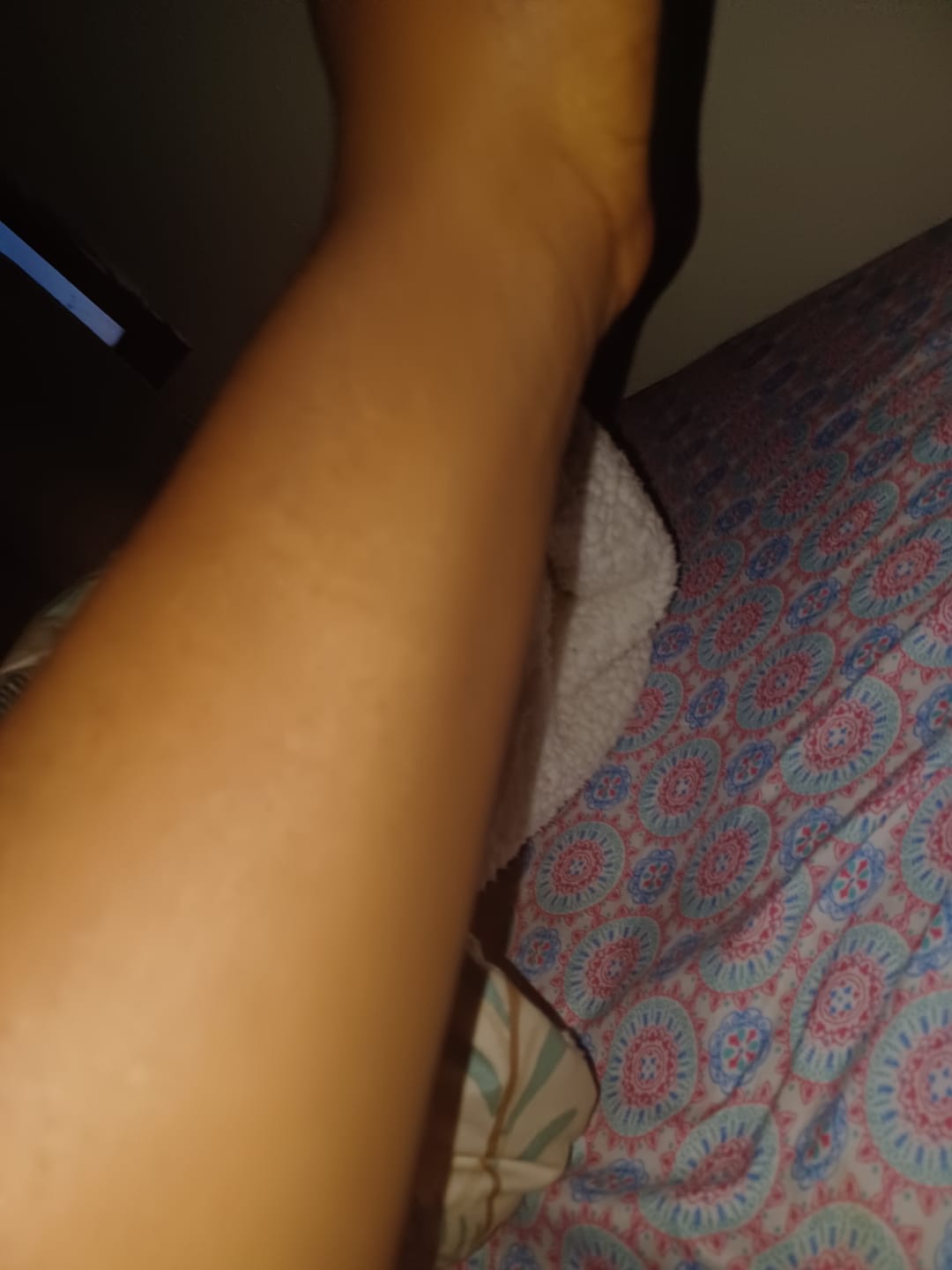 Customer photo review of Fair and White Glutathion Extra Serum Anti-Dark Spot 30ml / 1.01 Fl Oz