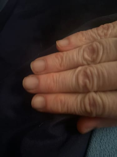 Customer photo review of The Nail System