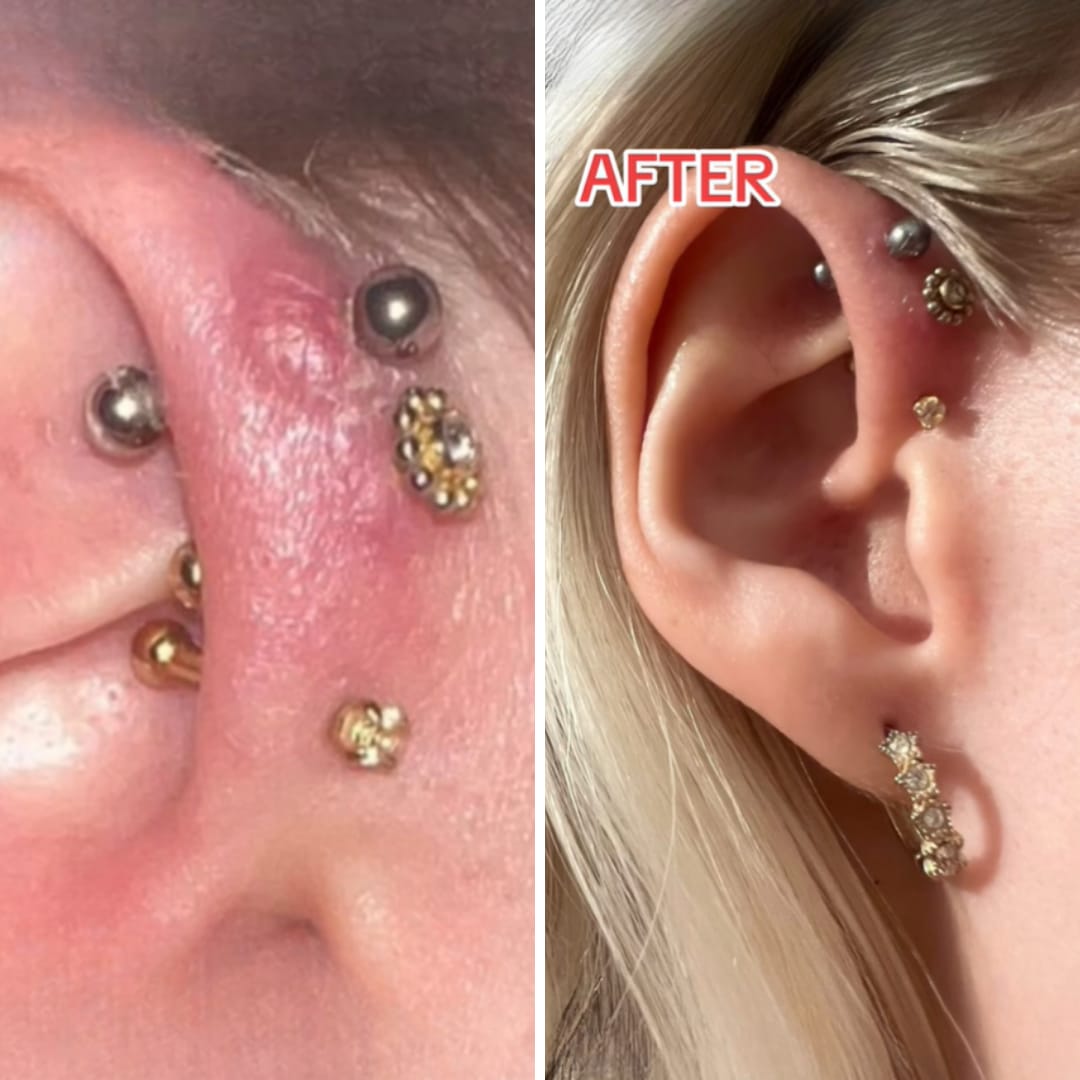 Customer photo review of Piercing Aftercare Hypochlorous Acid Spray