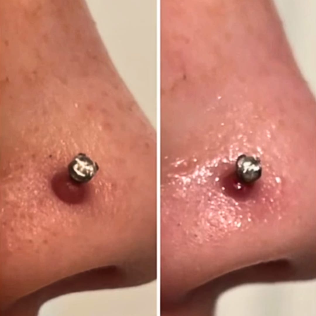 Customer photo review of Piercing Aftercare Hypochlorous Acid Spray