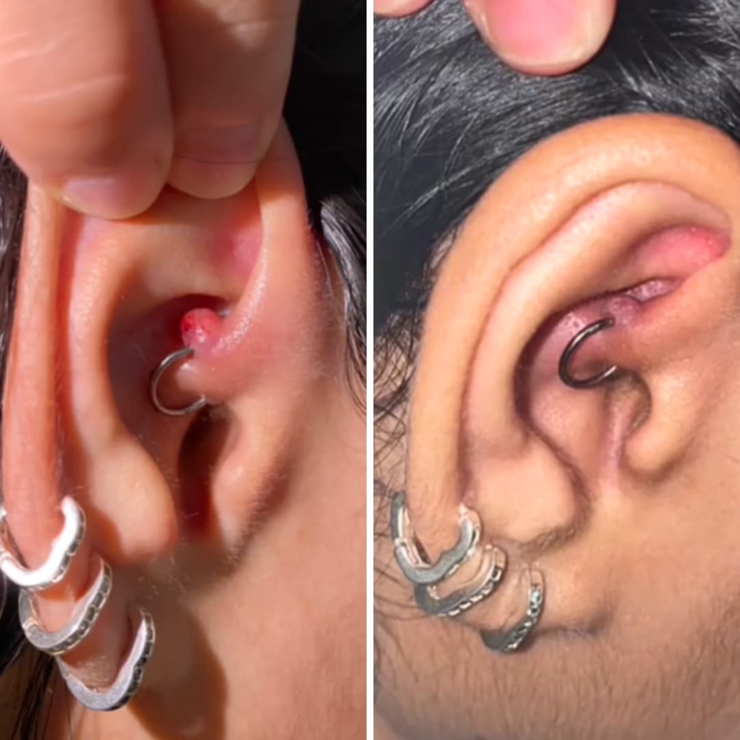 Customer photo review of Piercing Aftercare Hypochlorous Acid Spray