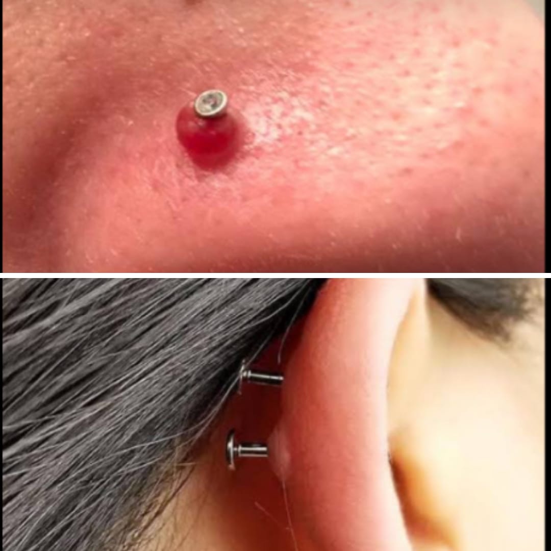Customer photo review of Piercing Aftercare Hypochlorous Acid Spray