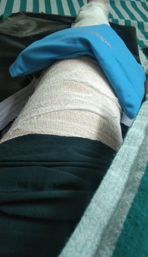 Customer photo review of Icecool Gel Pack | Re-Freezable for Instant Pain Relief & Swelling (Blue)