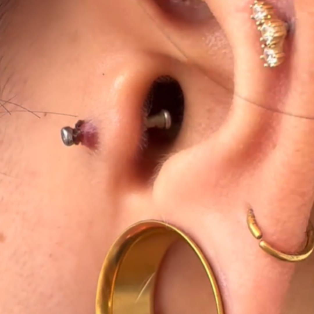 Customer photo review of Piercing Aftercare Hypochlorous Acid Spray