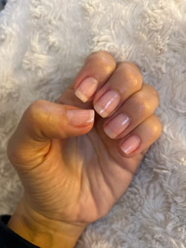 Customer photo review of The Complete Nail System