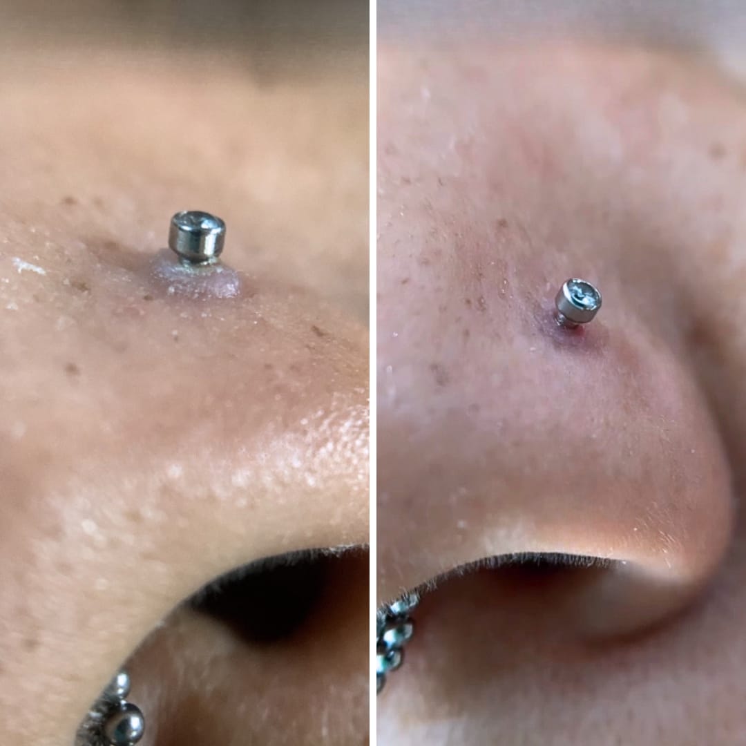 Customer photo review of Piercing Aftercare Hypochlorous Acid Spray