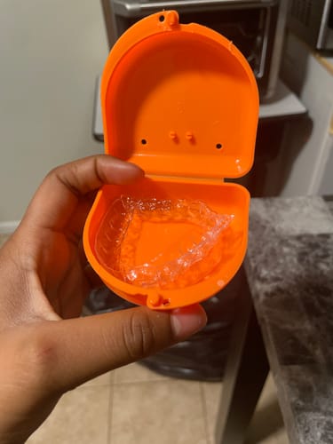 Customer photo review of Upper and Lower Retainers Set