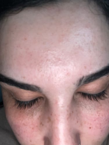Customer photo review of iGlow Lash Maximizer - Lash Serum, 3 ml