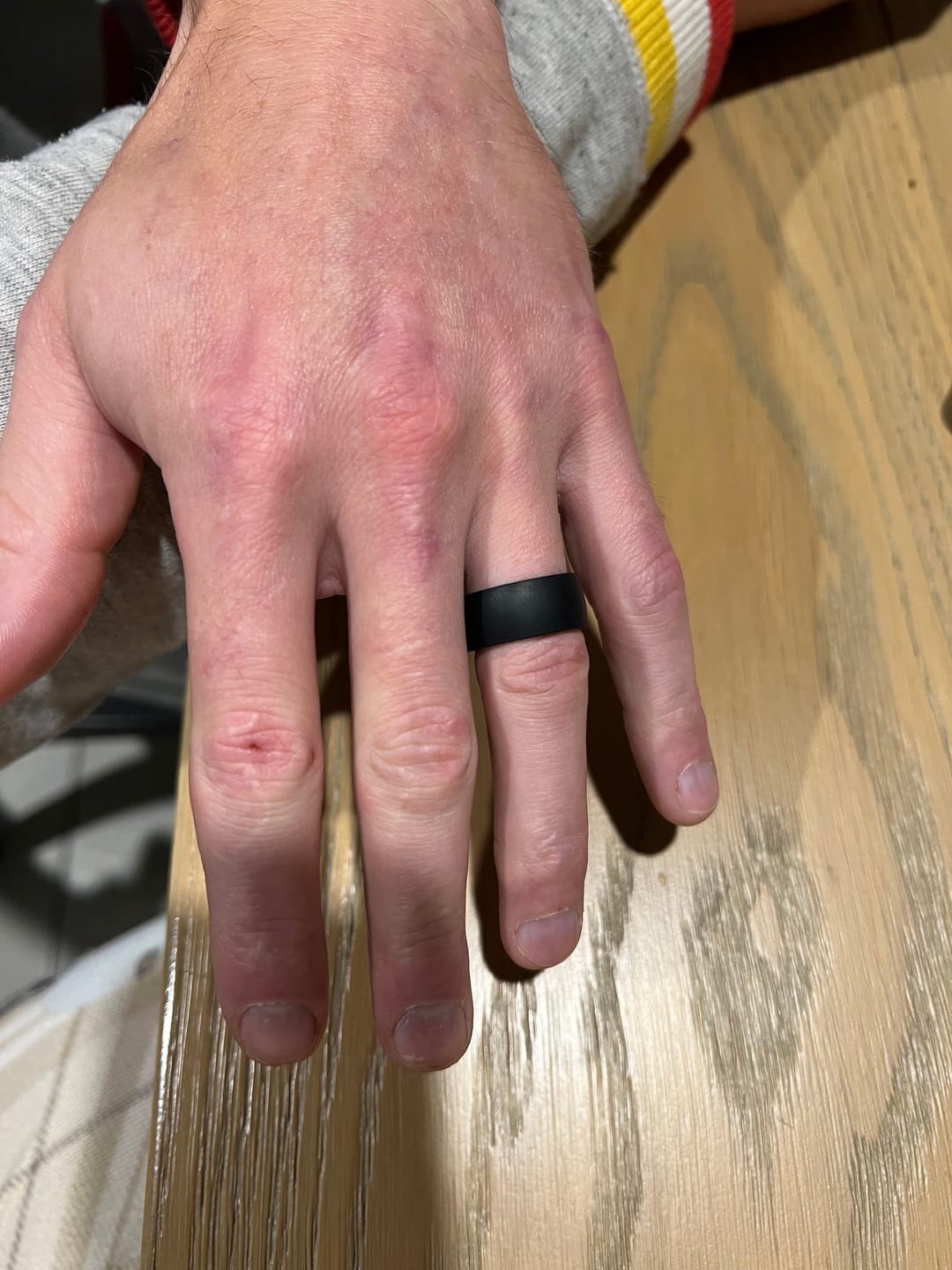 Customer photo review of The Shadow - Silicone Ring