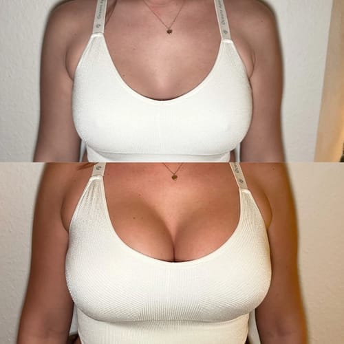 Customer photo review of LoveCups™ - Push-Pads