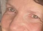 Reseña fotográfica de un cliente sobre el bálsamo para ojos