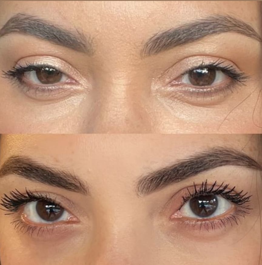 Customer photo review of Suero para crecimiento de pestañas y cejas