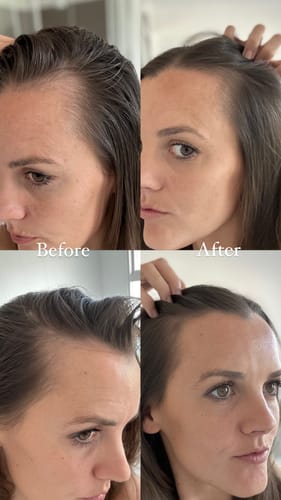 Customer photo review of Glow + Grow Hair Growth Collagen