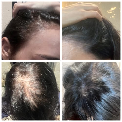Customer photo review of Glow + Grow Hair Growth Collagen
