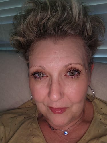 Customer photo review of SEA BUCKTHORN SERUM