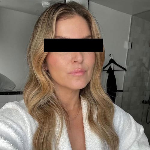 Customer photo review of Forever Young Anti-Ageing Treatment