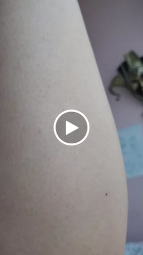 Customer video review of Depilador Nuva Skin®