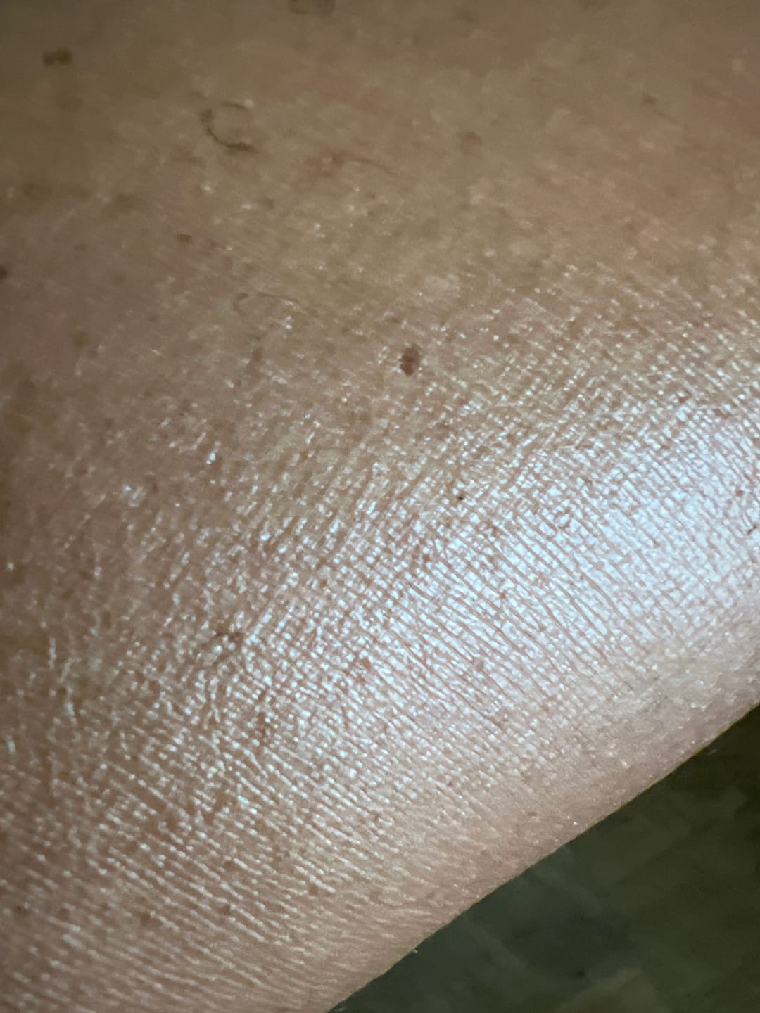 Customer photo review of ALKALINE SALVE