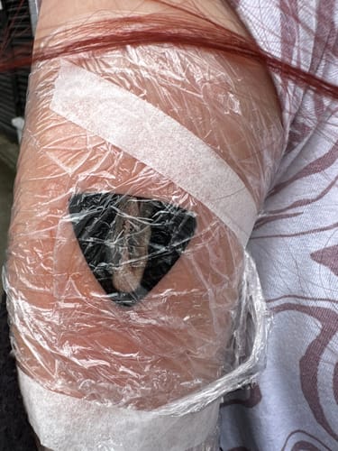 Customer photo review of TattooNumbx Numbing Cream