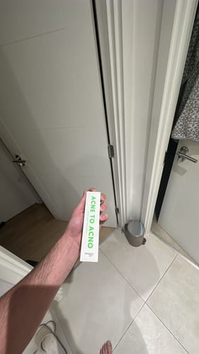 Customer photo review of Acne to Acno - Acne Treatment