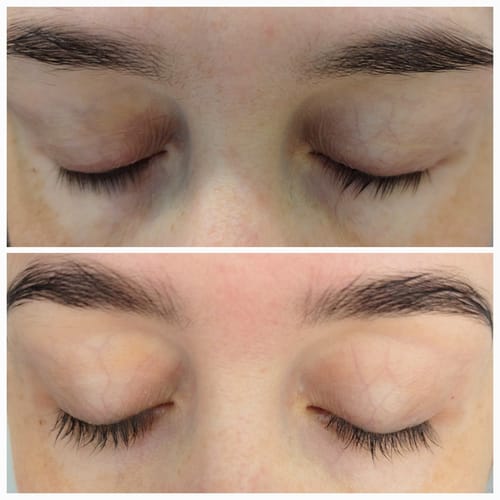 Customer photo review of LASH GROWTH SERUM