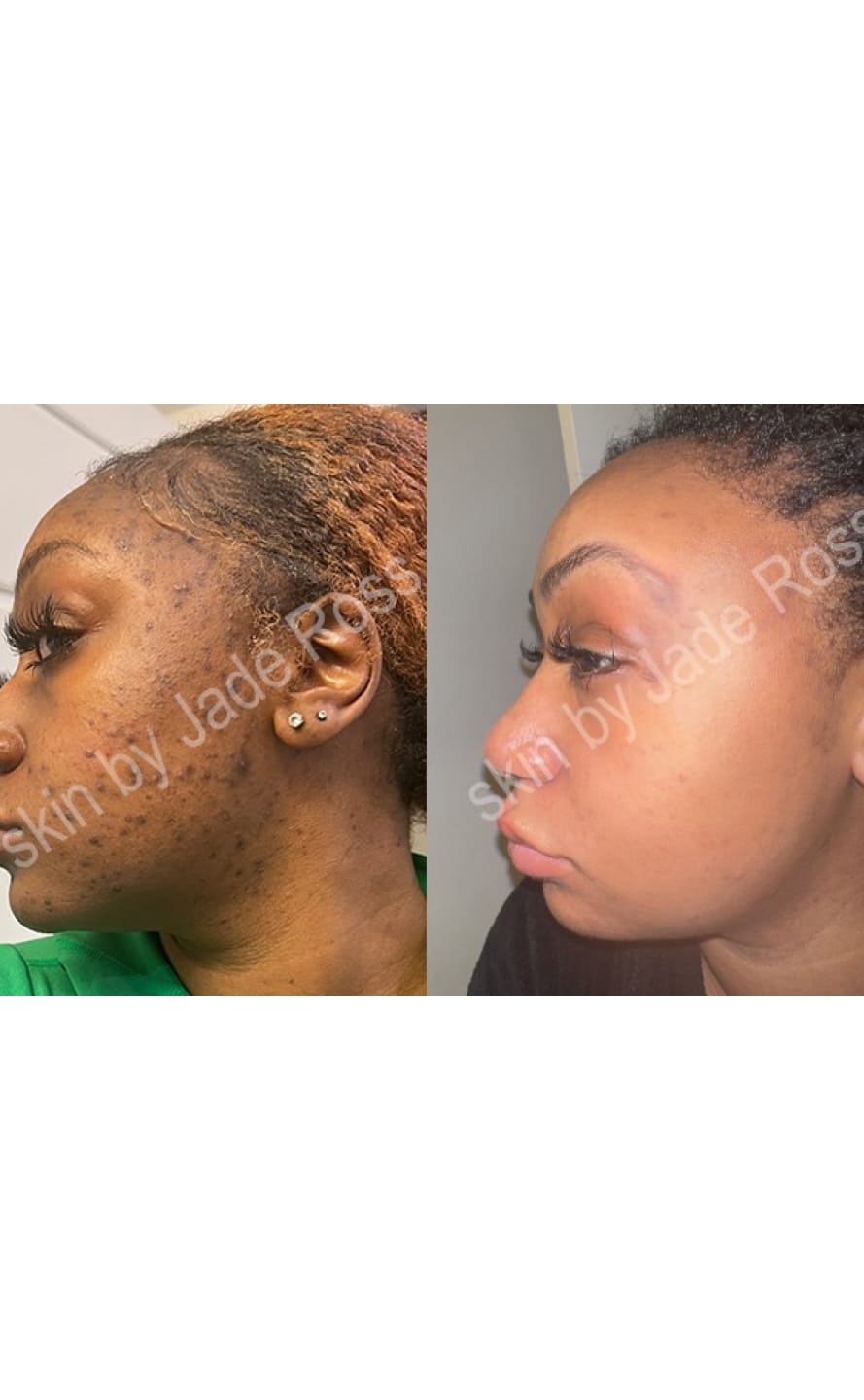 Customer photo review of Face Cream 2.0  (Brightening)