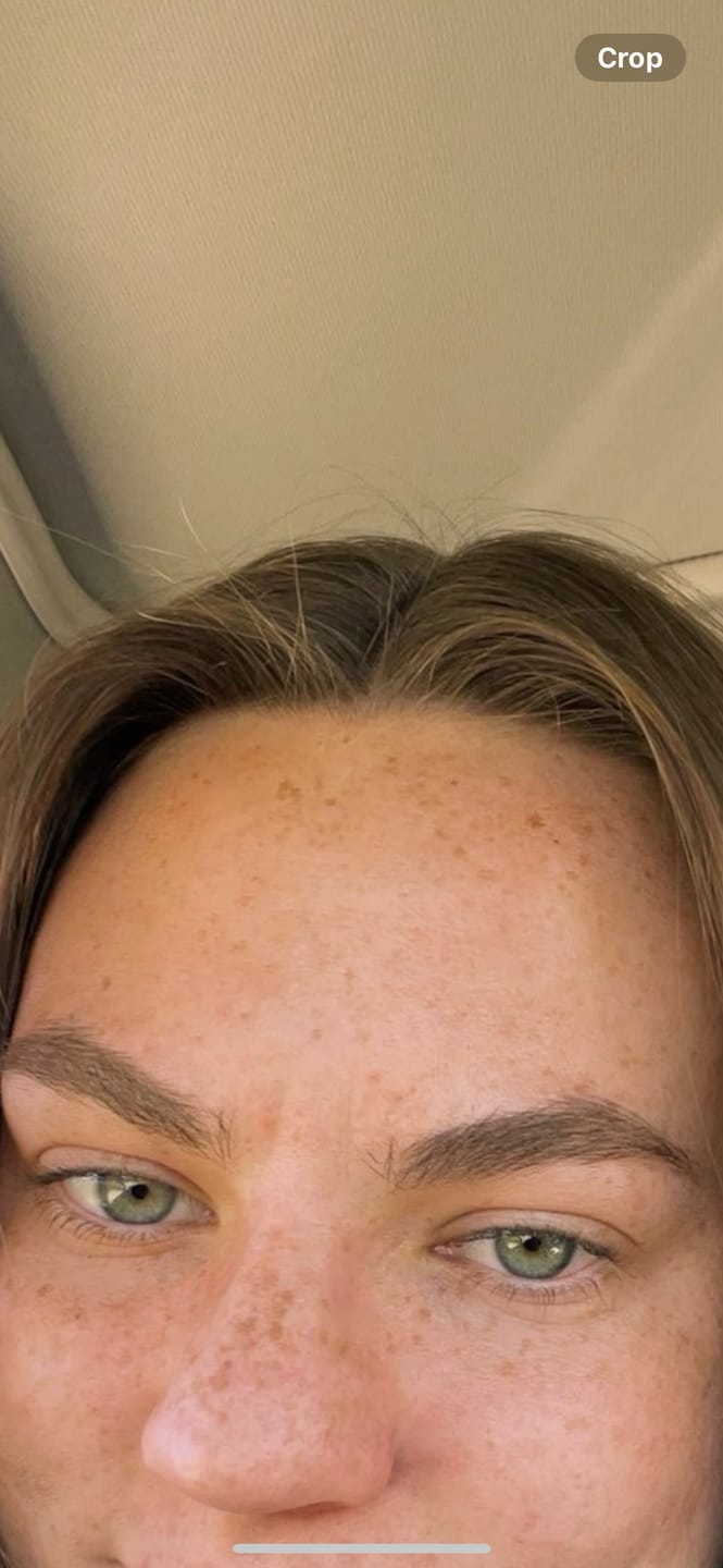 Customer photo review of Royal Jelly Daily Moisturizer