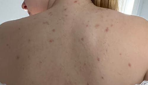 Customer photo review of Fade It! - Creme