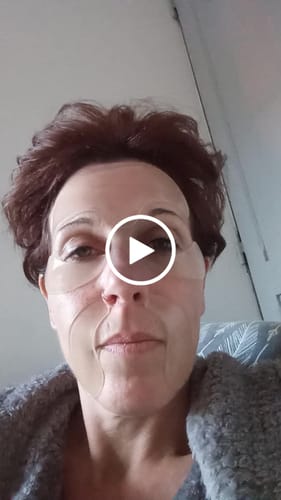 Customer video review of Patchs Visage Anti-Rides Réutilisables FontanaySkin™