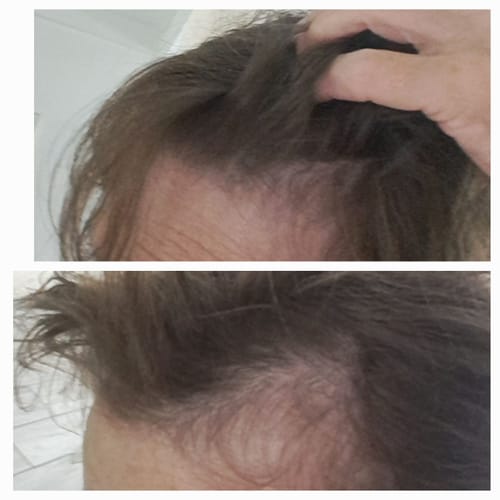 Customer photo review of Hair & Nail Capsules