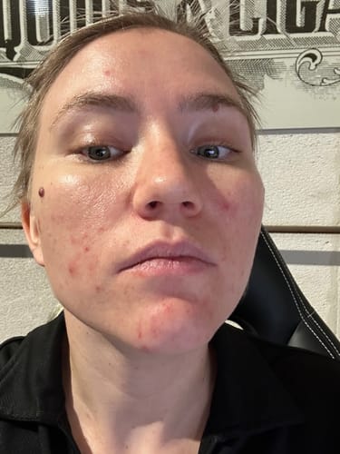 Customer photo review of 20-Day Inside & Out™ Gut Program