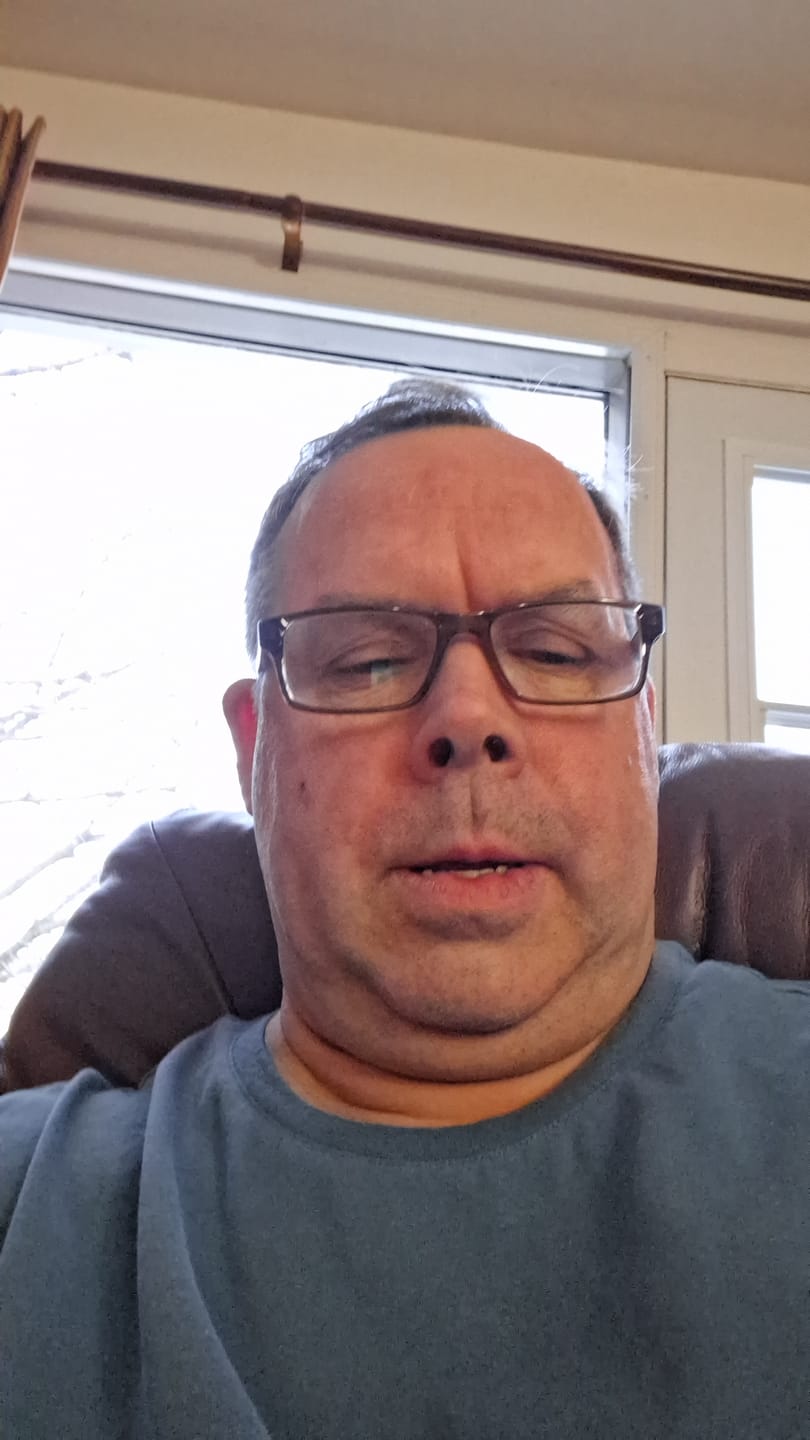 Customer photo review of Hyper-Release Pro Rapid Release Therapy Device