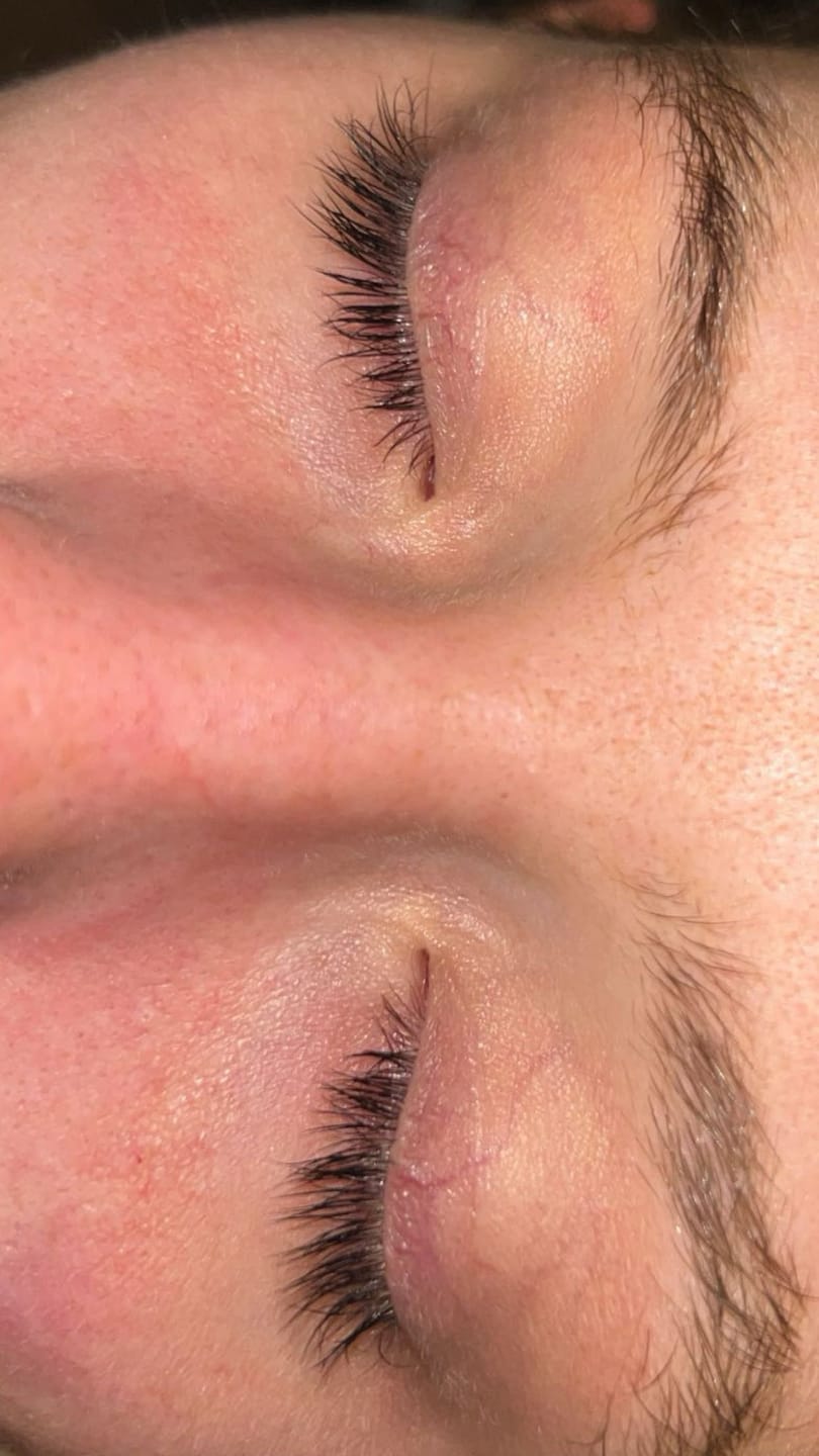Customer photo review of Purely Lashes Lash Growth Serum