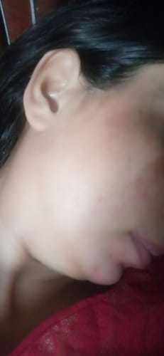 Customer photo review of Kids Sunblock SPF50