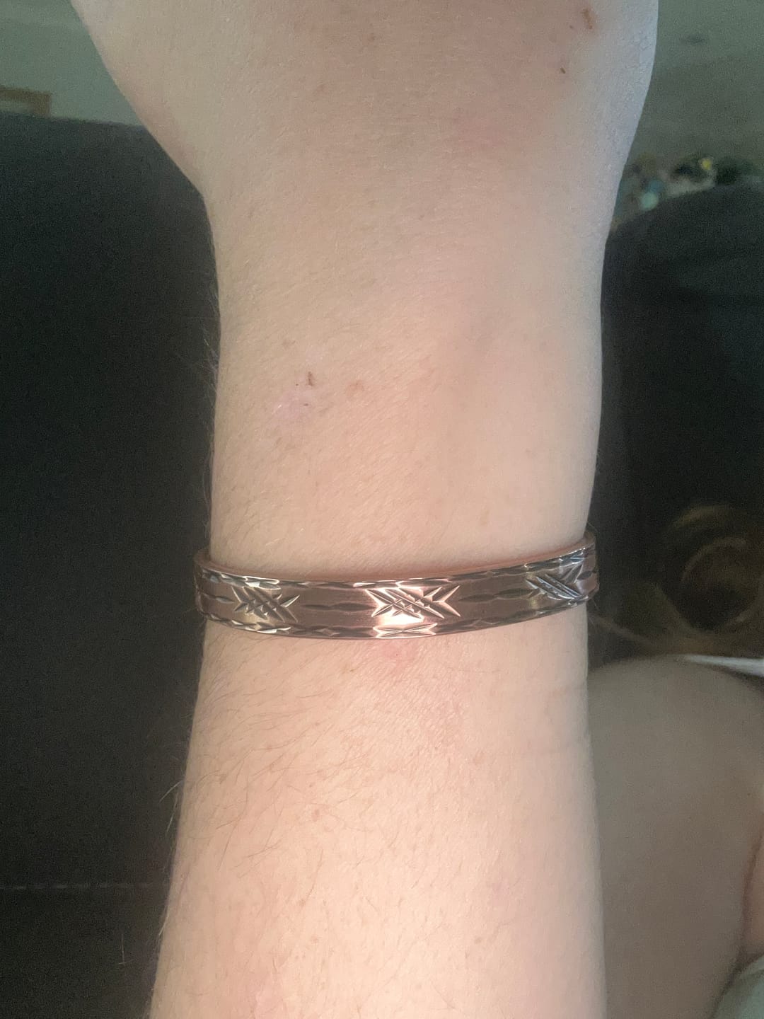 Customer photo review of Copper Band Barb  #cb6