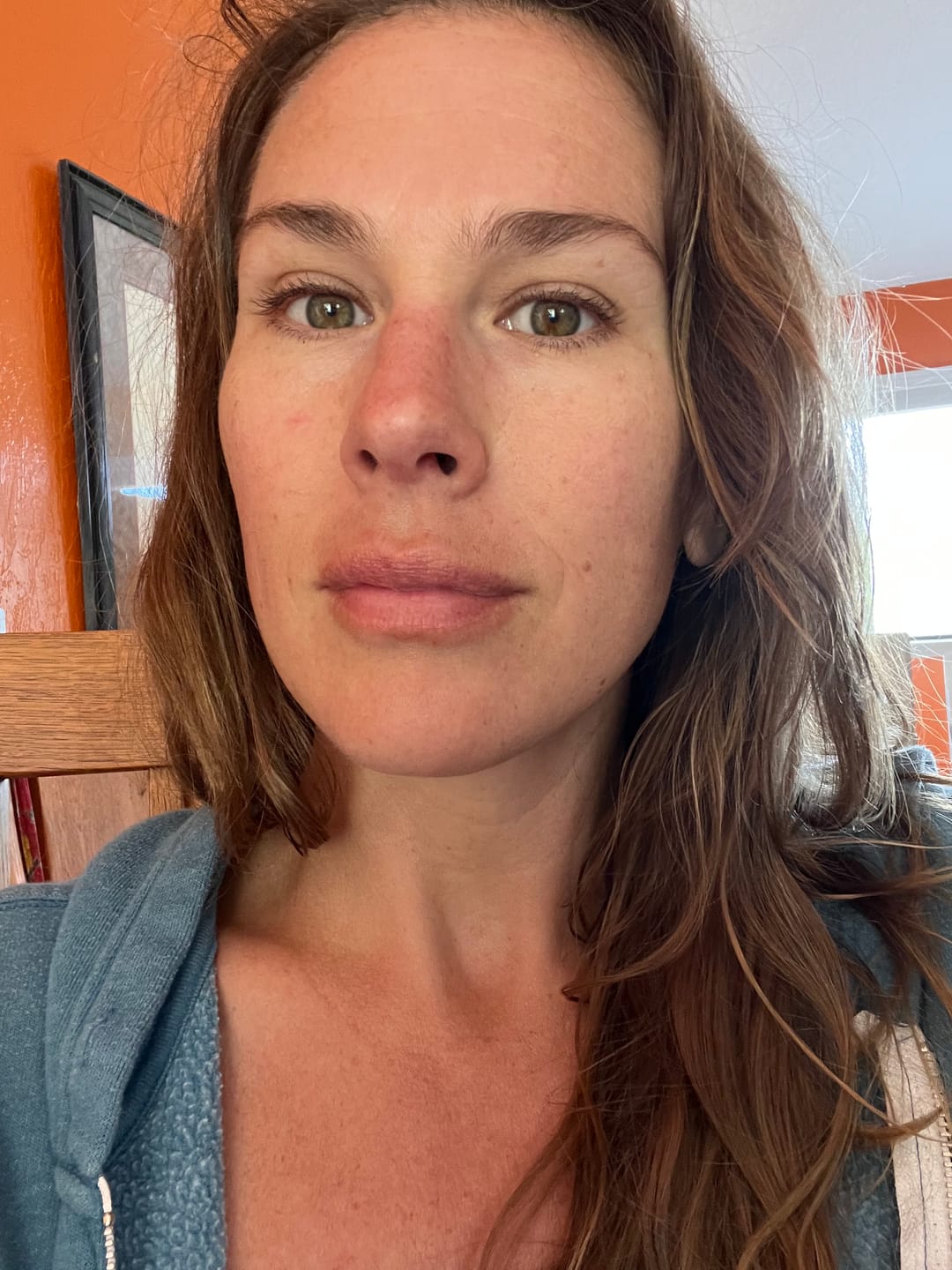 Customer photo review of F107 PEPTIDE POWER LIFT SERUM