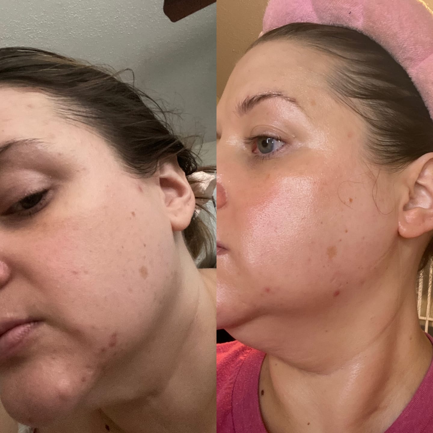Customer photo review of Extra Strength Fading Kit