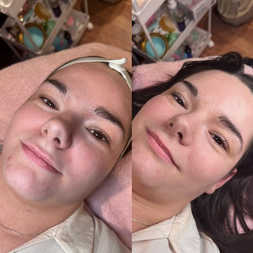 Customer photo review of Aqua Glue Gel