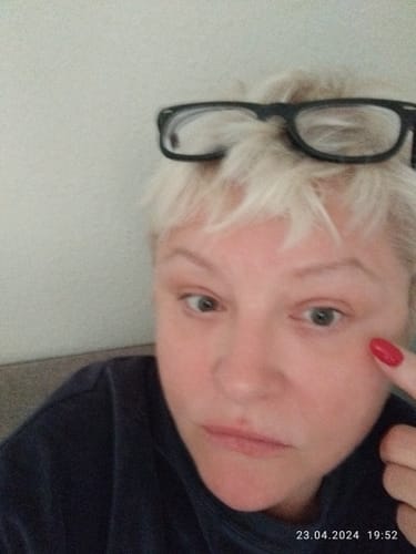 Customer photo review of Tagescreme mit Hyaluron | Day Cream