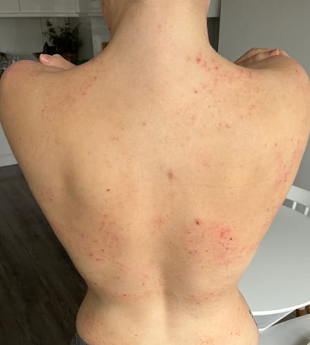 Customer photo review of Multi Strain Biotic