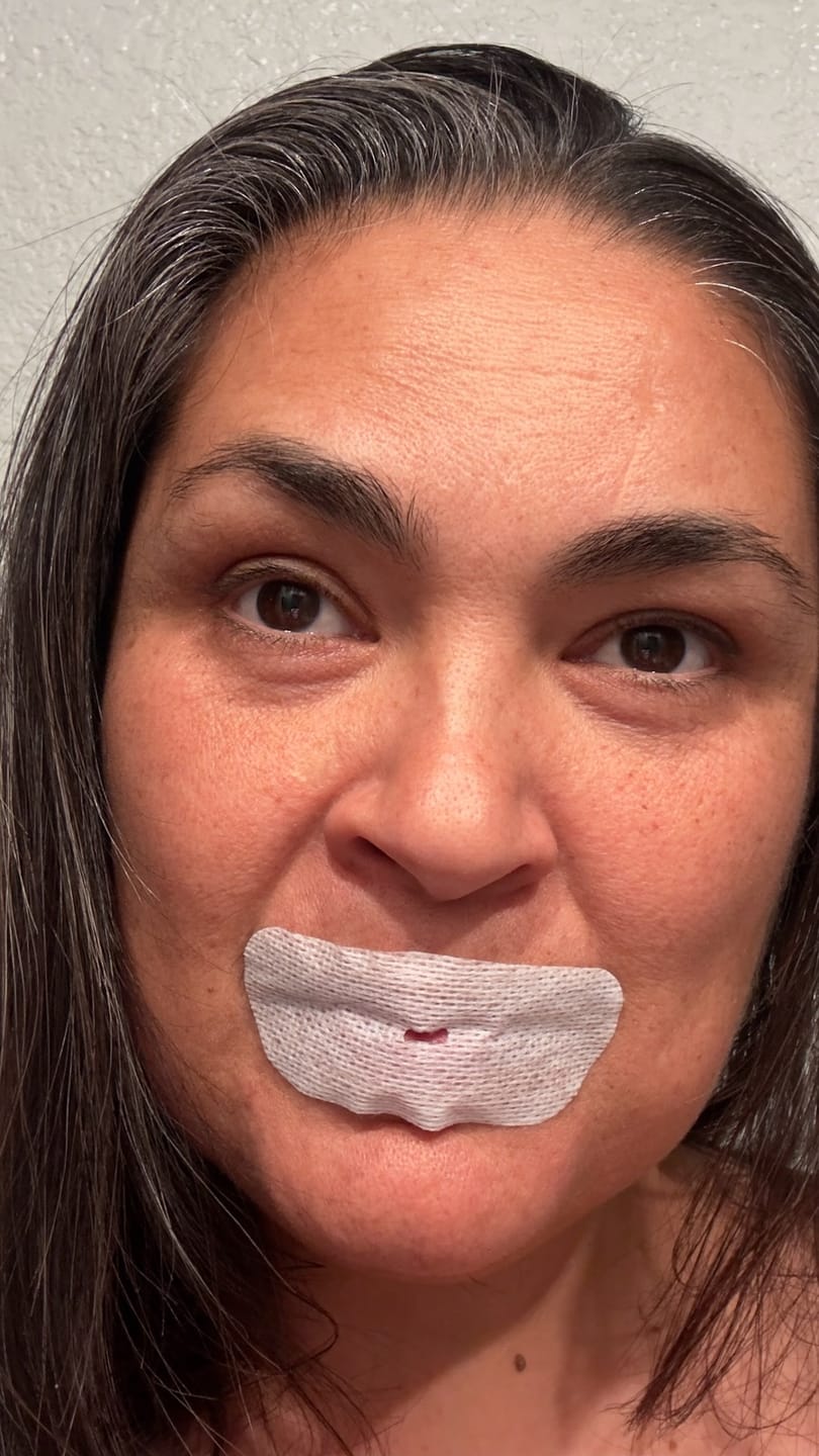 Customer photo review of oi tape™ mouth strips