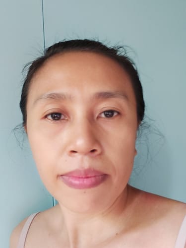 Customer photo review of Bad Skin™ Korean Collagen Bomb Hydrating Ampoule